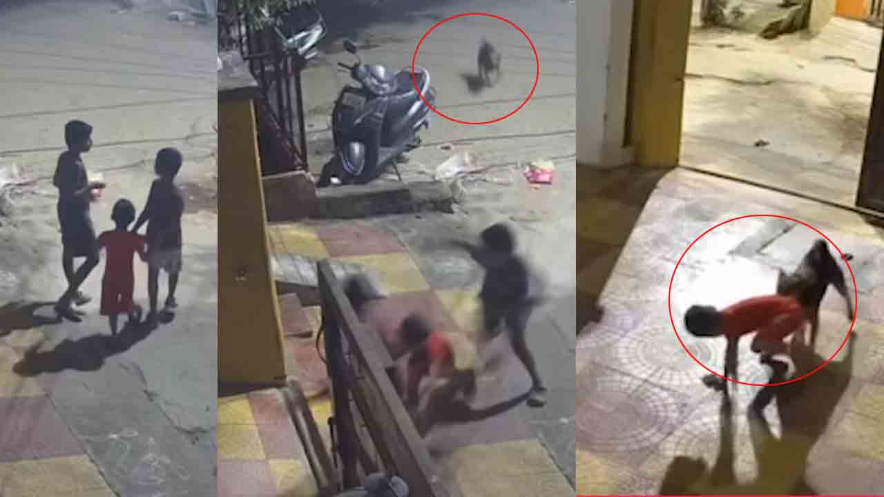 Dog Attack | దిల్‌సుఖ్‌న‌గ‌ర్‌లో వీధి కుక్క స్వైర‌విహారం.. ఐదేండ్ల బాలుడిపై దాడి