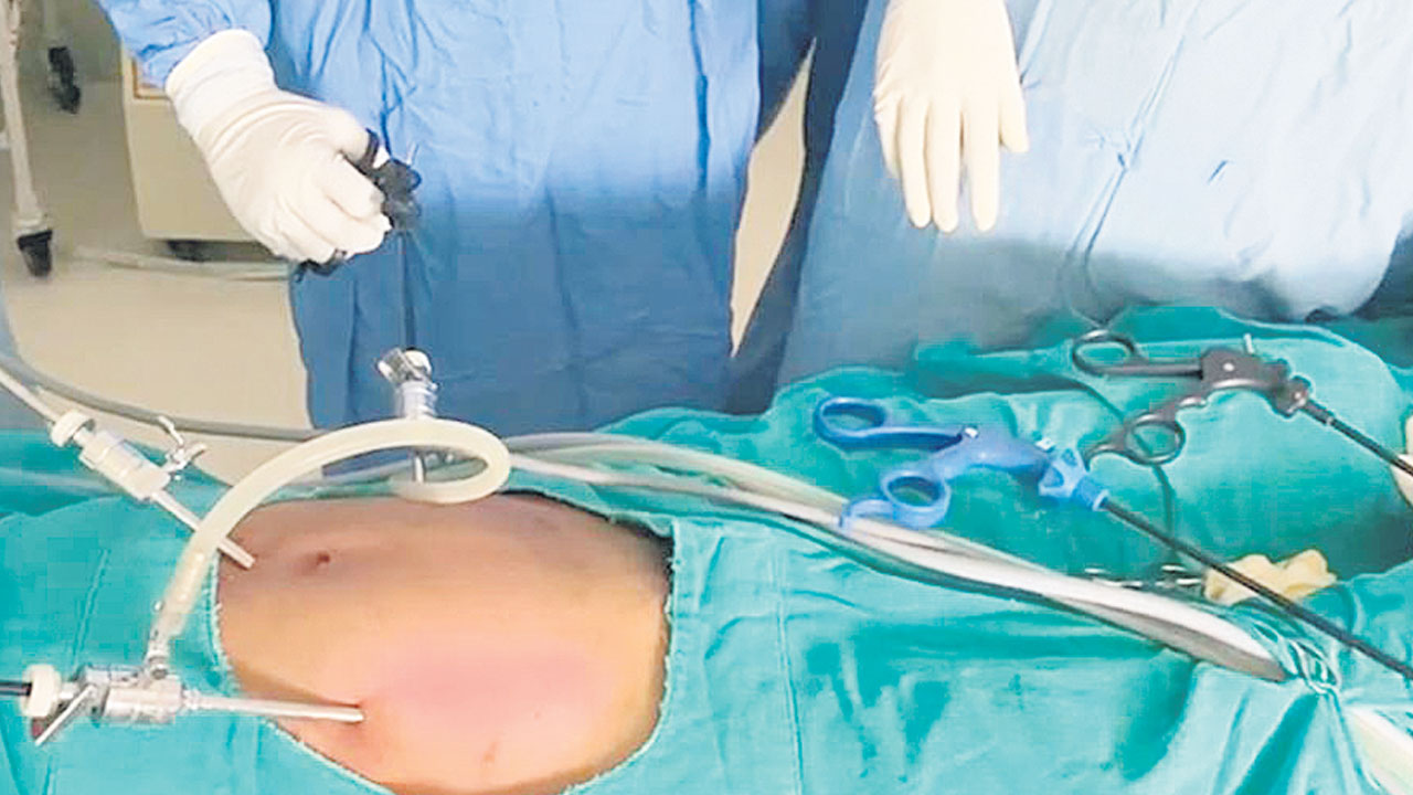 సర్కారు దవాఖానలో లాప్రోస్కోపిక్‌ ఆపరేషన్లు