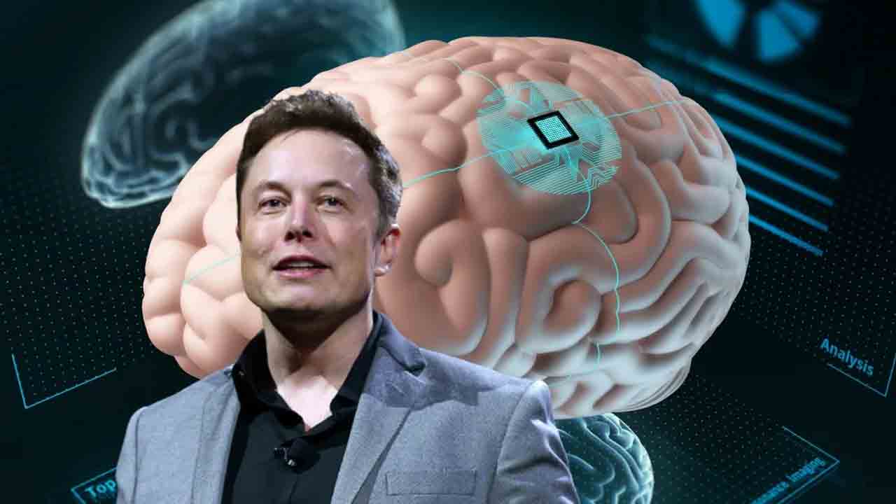 Brain Chip | మనిషి మెదడులో బ్రెయిన్‌ చిప్‌.. ఇది ఎలా పనిచేస్తుందంటే?…