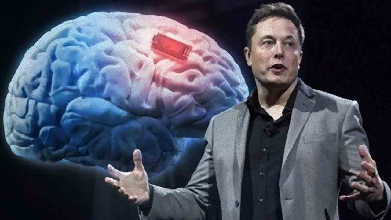 Elon Musk | మనిషి మెదడులో ‘చిప్’.. విజయవంతమైందన్న ఎలన్ మస్క్..!
