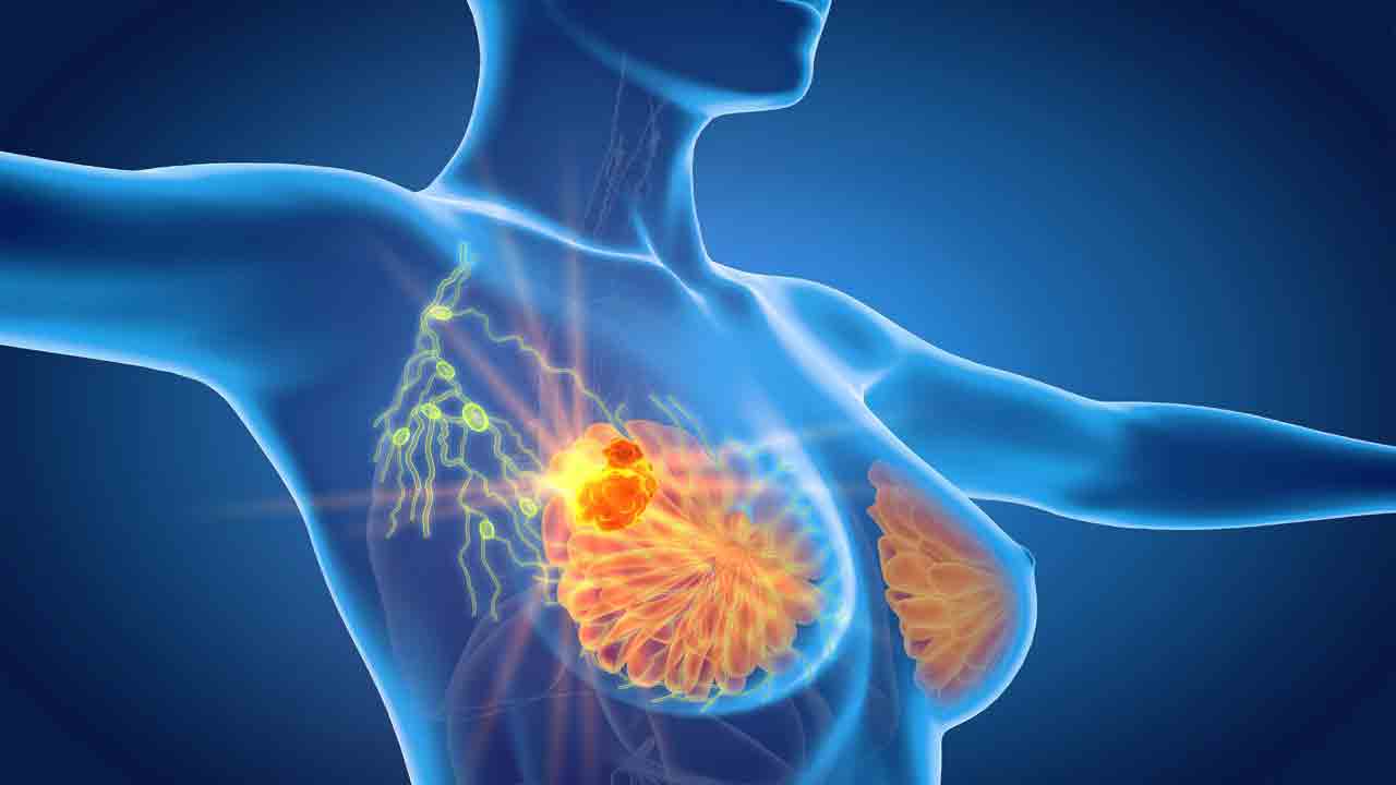 Breast Reconstruction | బ్రెస్ట్‌ రీకన్‌స్ట్రక్షన్‌ వల్ల లాభాలున్నాయా ? ఈ సర్జరీ వల్ల ఎవరికి ఎక్కువ అవసరం ?