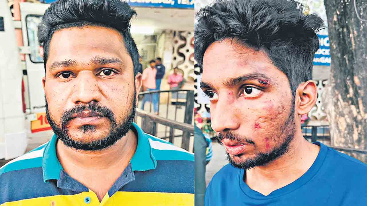 Congress | కాంగ్రెస్‌ రౌడీయిజం.. జూబ్లీహిల్స్‌లో బీఆర్‌ఎస్‌ కార్యకర్తల కిడ్నాప్‌, దాడి