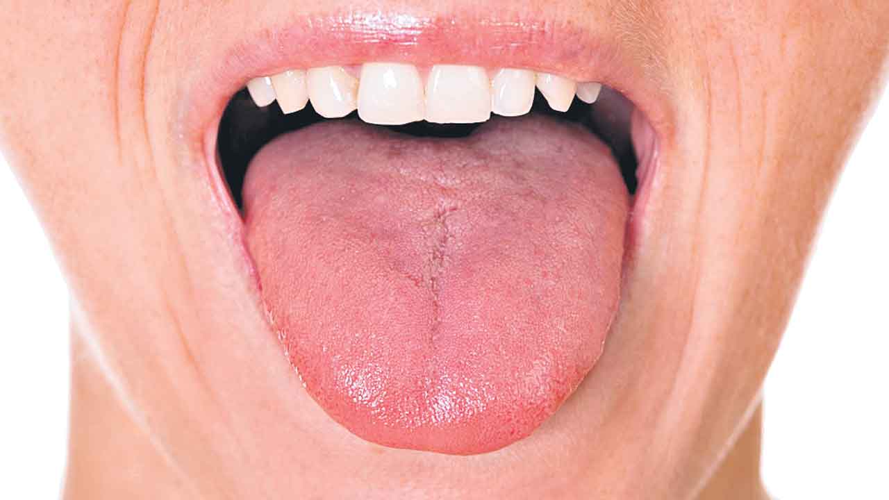 Artificial Tongue | ఆర్టిఫిషియల్‌ టంగ్‌.. ఇక నోటికి సంబంధించిన వ్యాధులకు చెక్‌!