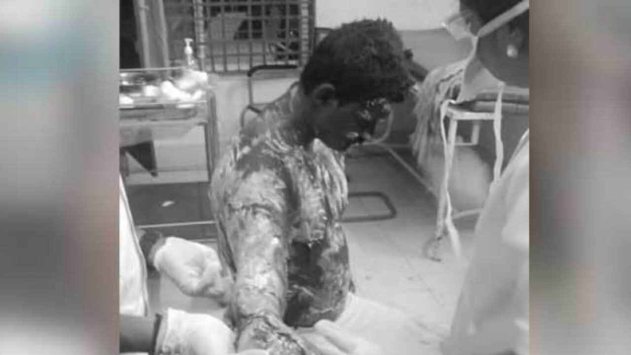 Hyderabad | దారి విషయంలో తగాదా.. అన్నపై పెట్రోల్‌ పోసి నిప్పంటించిన తమ్ముడు