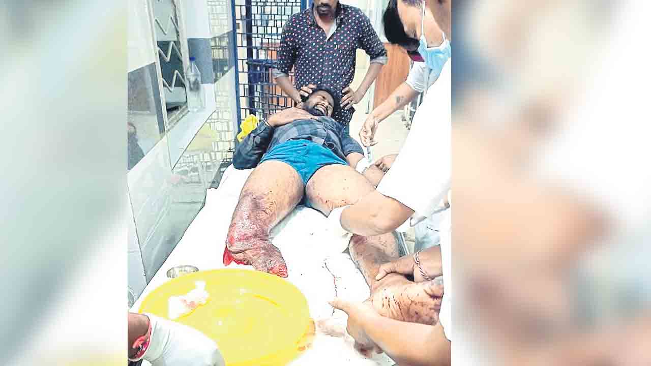 డంపర్‌ను ఢీకొట్టిన వోల్వా వాహనం