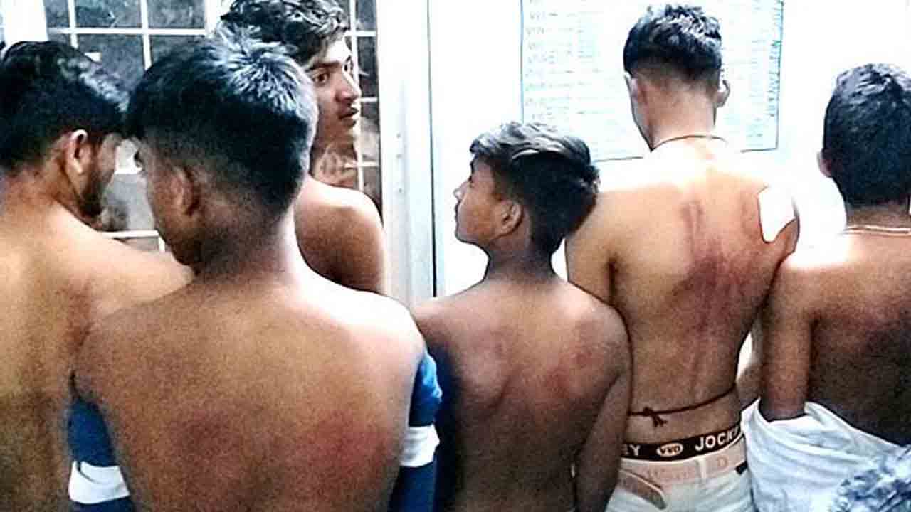 Tribal Welfare | మార్కులు తక్కువ వచ్చాయని టెన్త్ విద్యార్థులను చితకబాదిన తెలుగు టీచర్