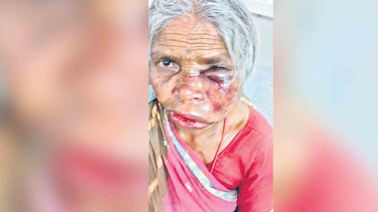 తులంన్నర బంగారం కోసం.. తల్లిపై పైశాచిక దాడి