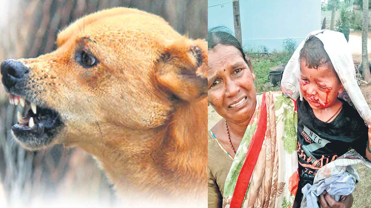 Stray Dogs | కనిపిస్తే కరిచేస్తున్నాయ్‌.. గ్రేటర్‌లో వీరంగం సృష్టిస్తున్న వీధి కుక్కలు