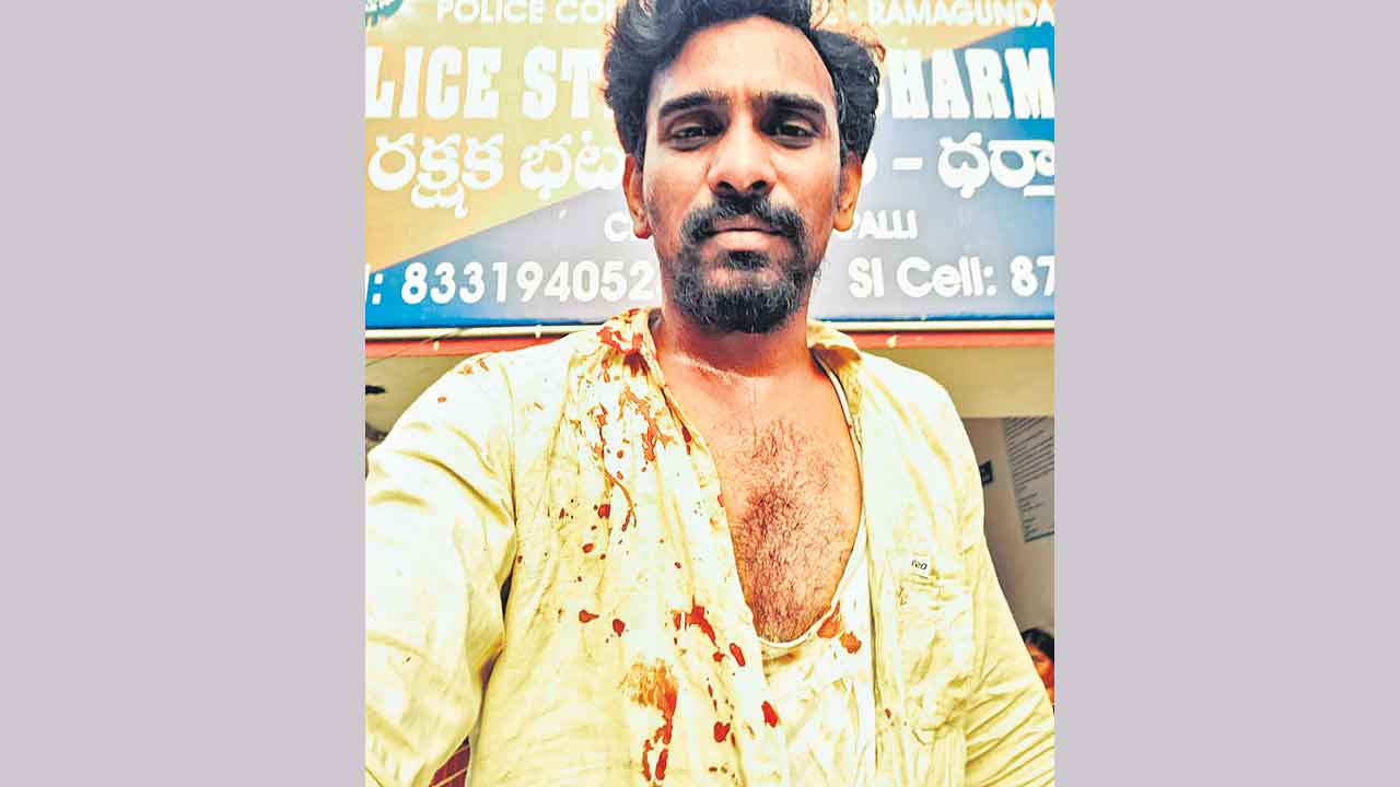 బీఆర్‌ఎస్‌ సోషల్‌మీడియా కార్యదర్శిపై దాడి