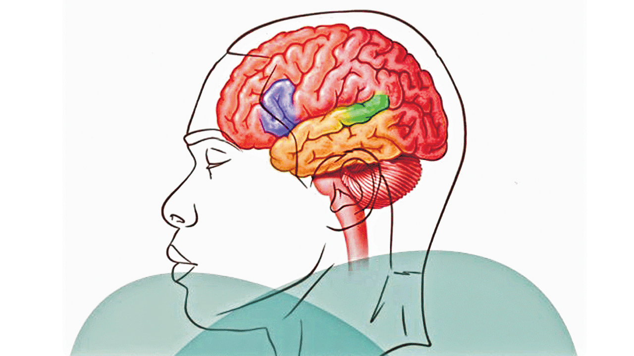 Aphasia | మాటలో తడబాటు.. నడివయసు, వృద్ధాప్యంలో దాపురించే అఫేసియా