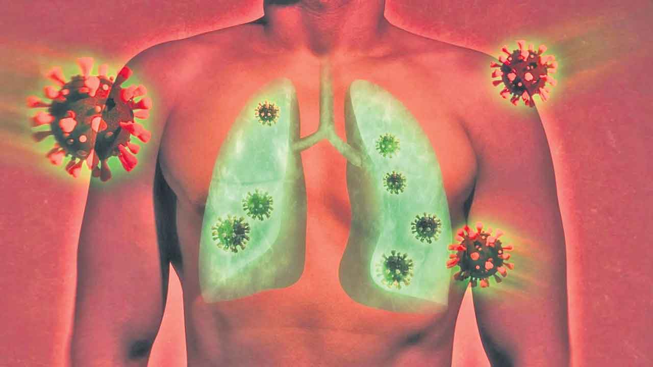 Covid-19 | శరీరంలో ఏడాది పాటు కొవిడ్‌ వైరస్‌!