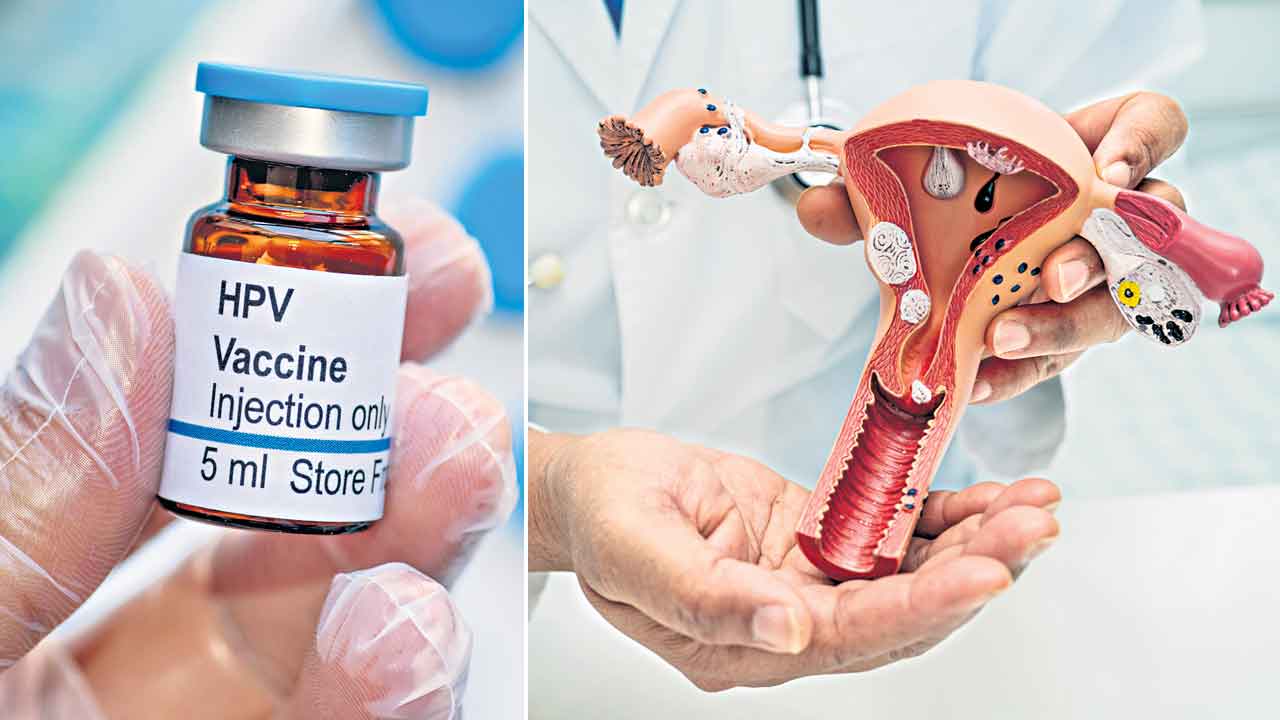 HPV Vaccine | టీకాతో సర్వైవ్.. హెచ్‌పీవీ వ్యాక్సిన్‌తో సర్వైకల్‌ క్యాన్సర్‌కు చెక్‌