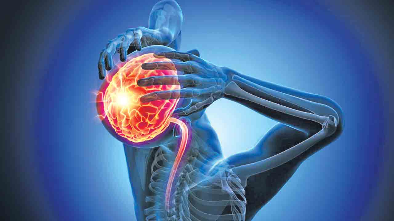 Health Tips | వాటికి దూరంగా ఉంటే చాలు.. మైగ్రేన్‌కు చిట్కా చికిత్స