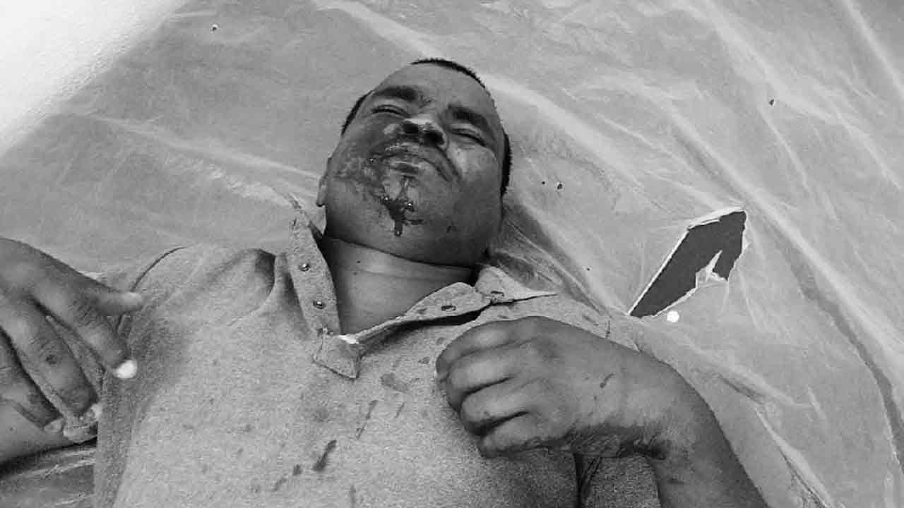 MLA Vivek | జర్నలిస్ట్ వెంకటేశ్‌పై ఎమ్మెల్యే వివేక్ అనుచరుల దాడి..