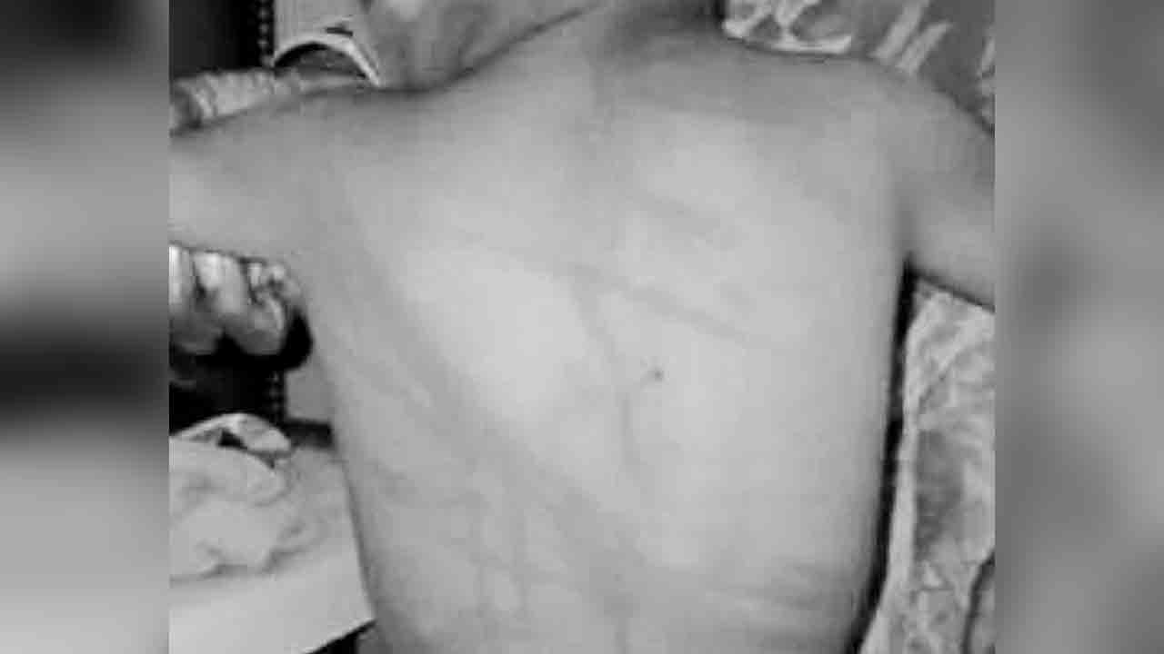 Chicken | కోడి మాంసం తిన‌లేద‌ని కొడుకుని చిత‌క‌బాదిన తండ్రి