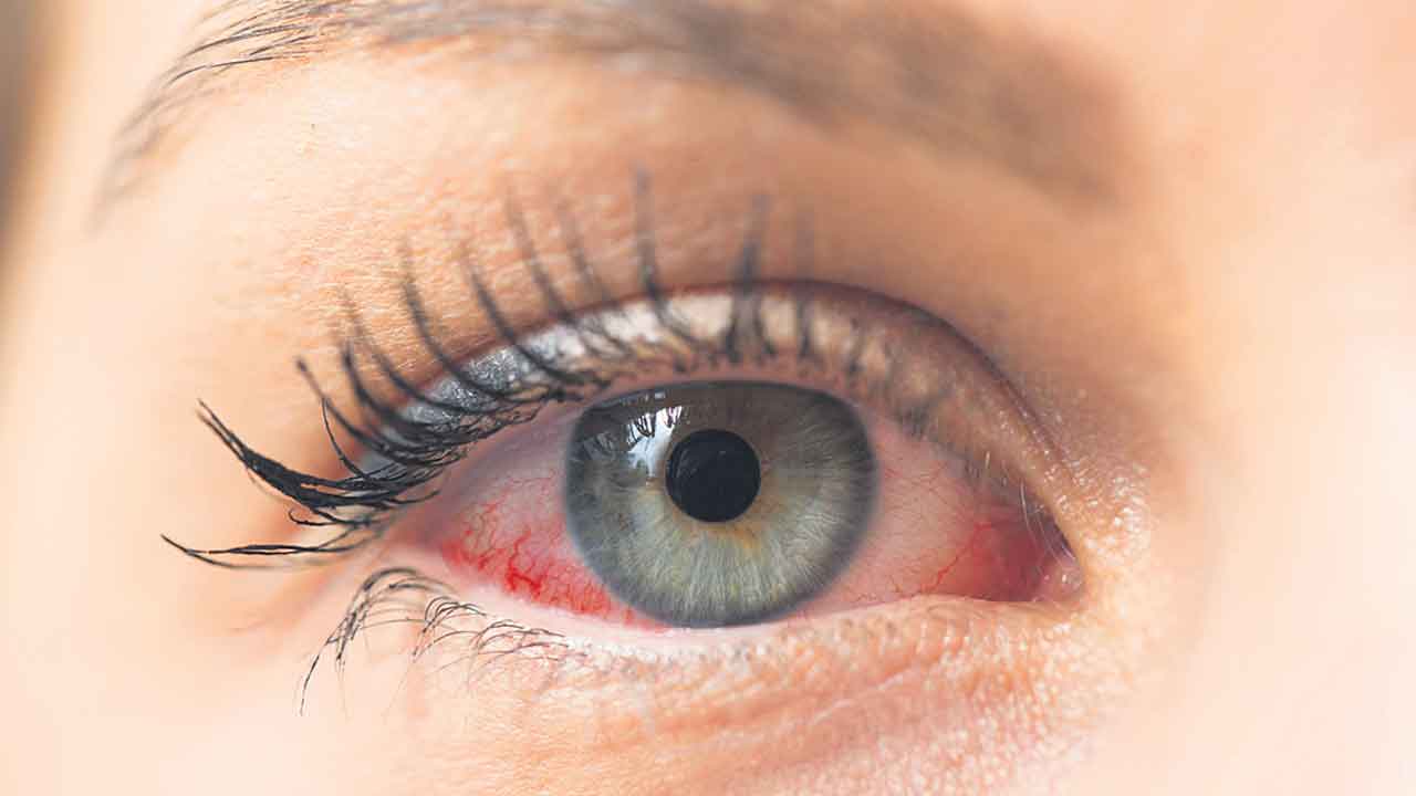 కంటికి రెప్పలా..