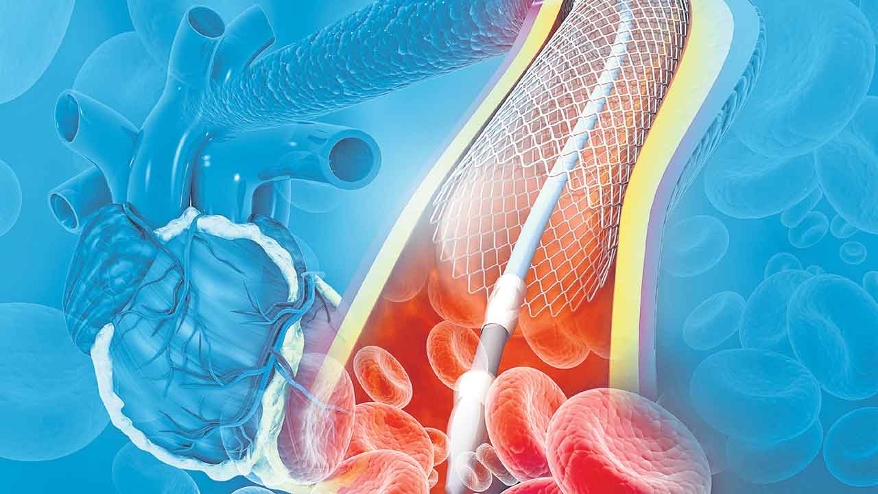 Heart Angioplasty | గుండెపోటు వచ్చే ముందు కనిపించే లక్షణాలివే