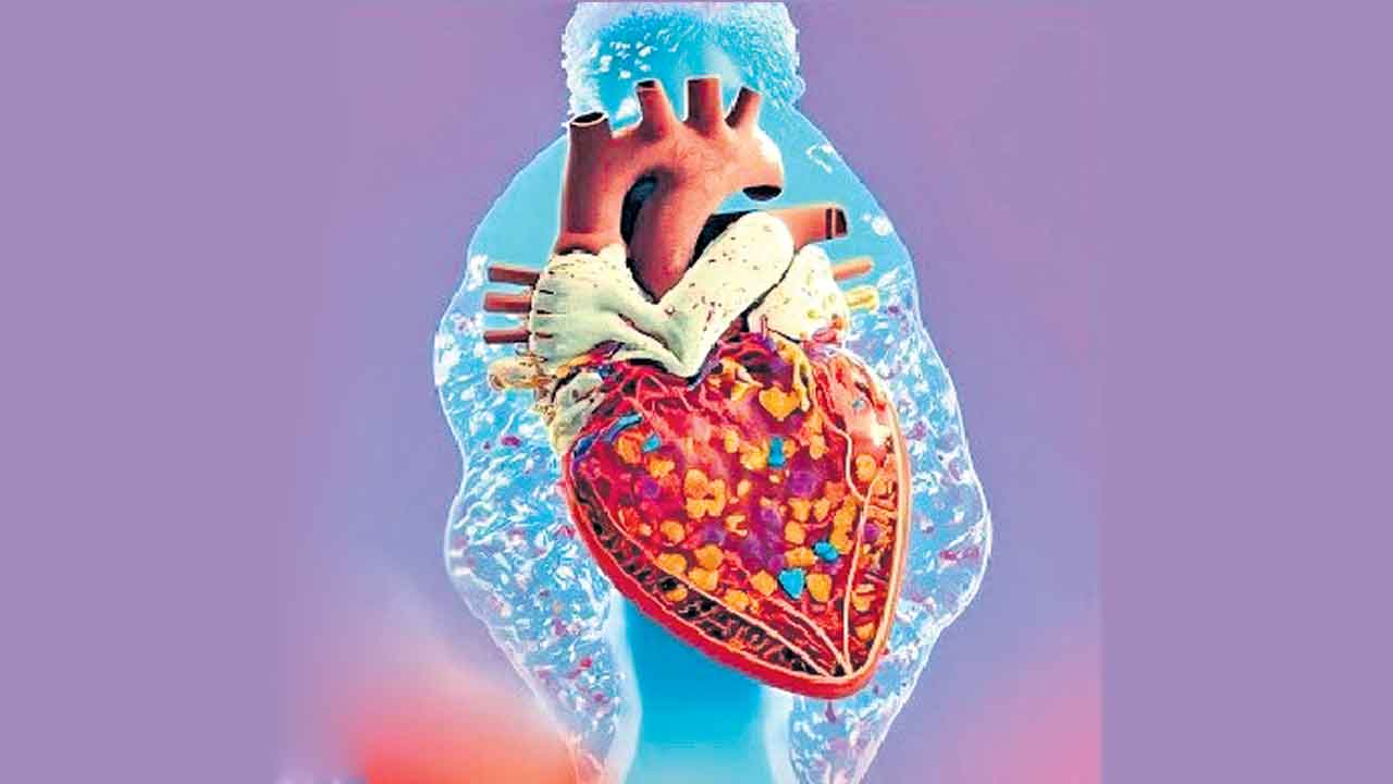 మైక్రో, నానో ప్లాస్టిక్‌తో గుండెపోటు!