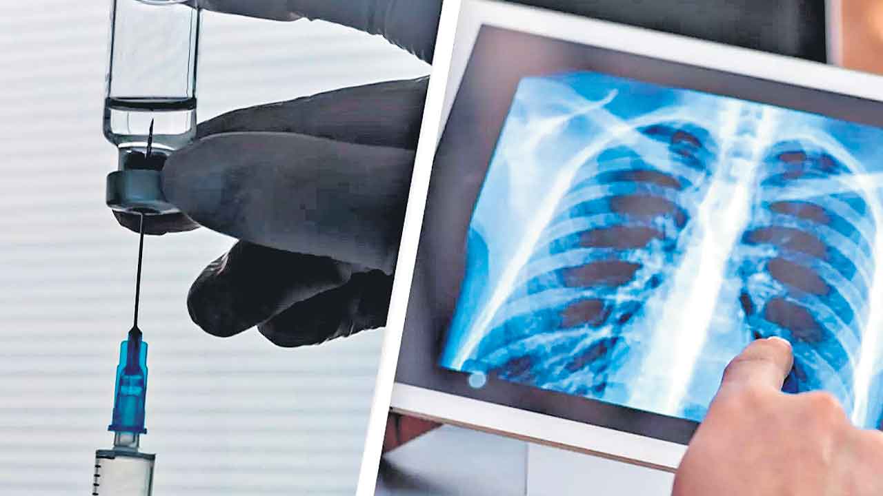 Lungs Cancer | ఊపిరితిత్తుల క్యాన్సర్‌కు వ్యాక్సిన్‌తో విరుగుడు!