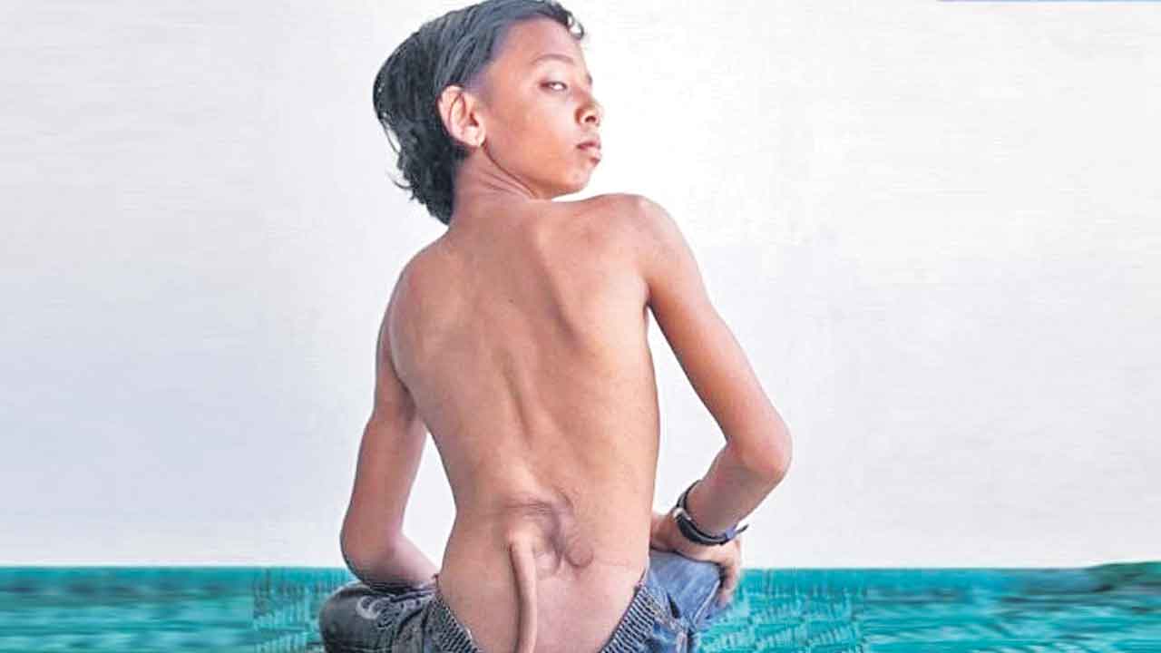 Jumping Genes | ఆ జన్యువుల వల్లే మనుషుల్లో తోకలు పెరుగడం నిలిచిపోయాయట!