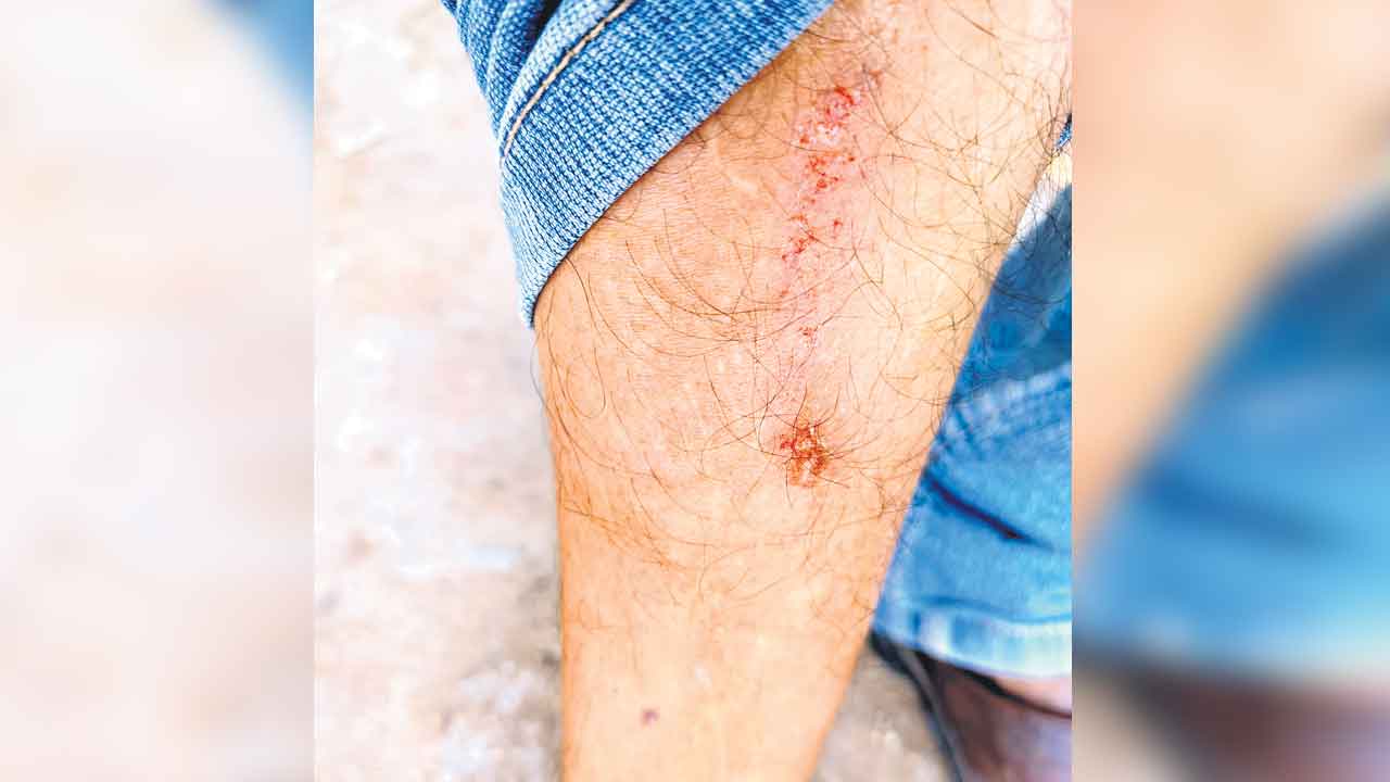 ‘నమస్తే’ జర్నలిస్టుపై ఇన్‌స్పెక్టర్‌ దాడి