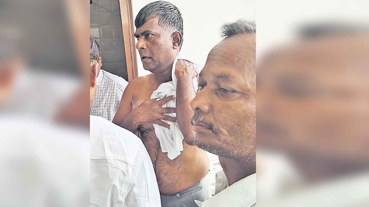 తనను కాల్చేయాలని ఎమ్మెల్యేకు అగ్గిపెట్టె