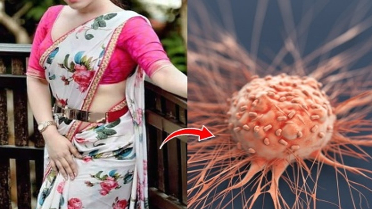Saree Cancer | చీరతో క్యాన్సర్‌ ముప్పు..! అధ్యయనంలో కీలక విషయాలు వెలుగులోకి..!
