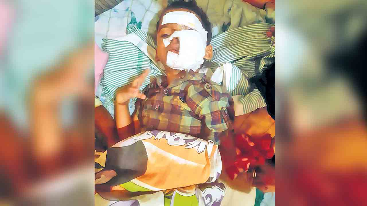 బాలుడిపై వీధి కుక్కల దాడి