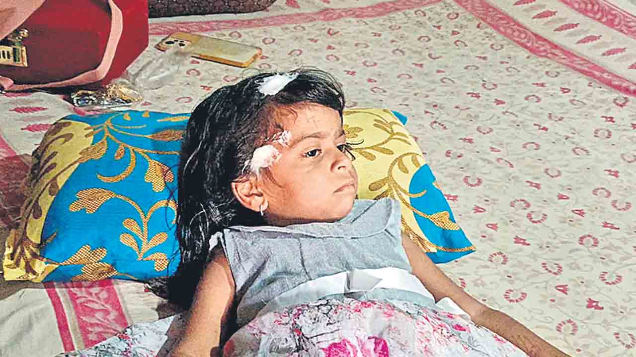 చిన్నారిపై వీధి కుక్క దాడి