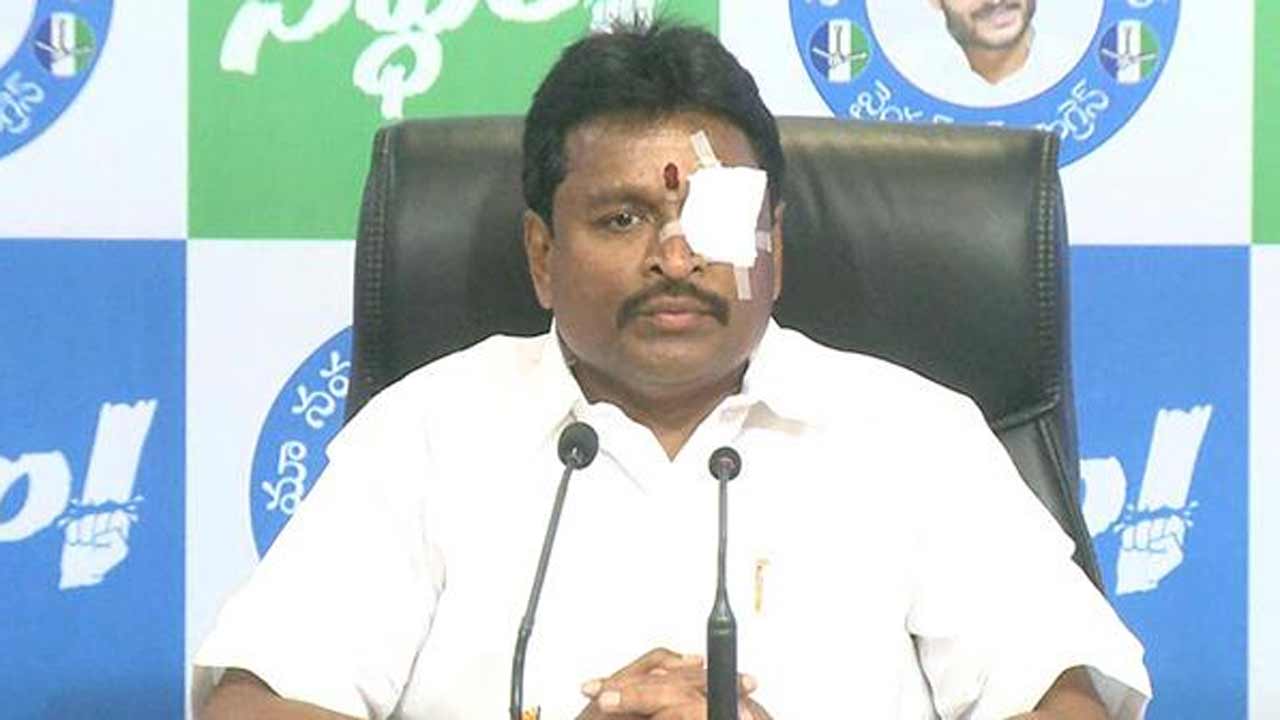 Vellampalli Srinivas | ఎవరైనా కావాలని కంటిపై గాయం చేసుకుంటారా? టీడీపీ ఆరోపణల్ని ఖండించిన వెల్లంపల్లి