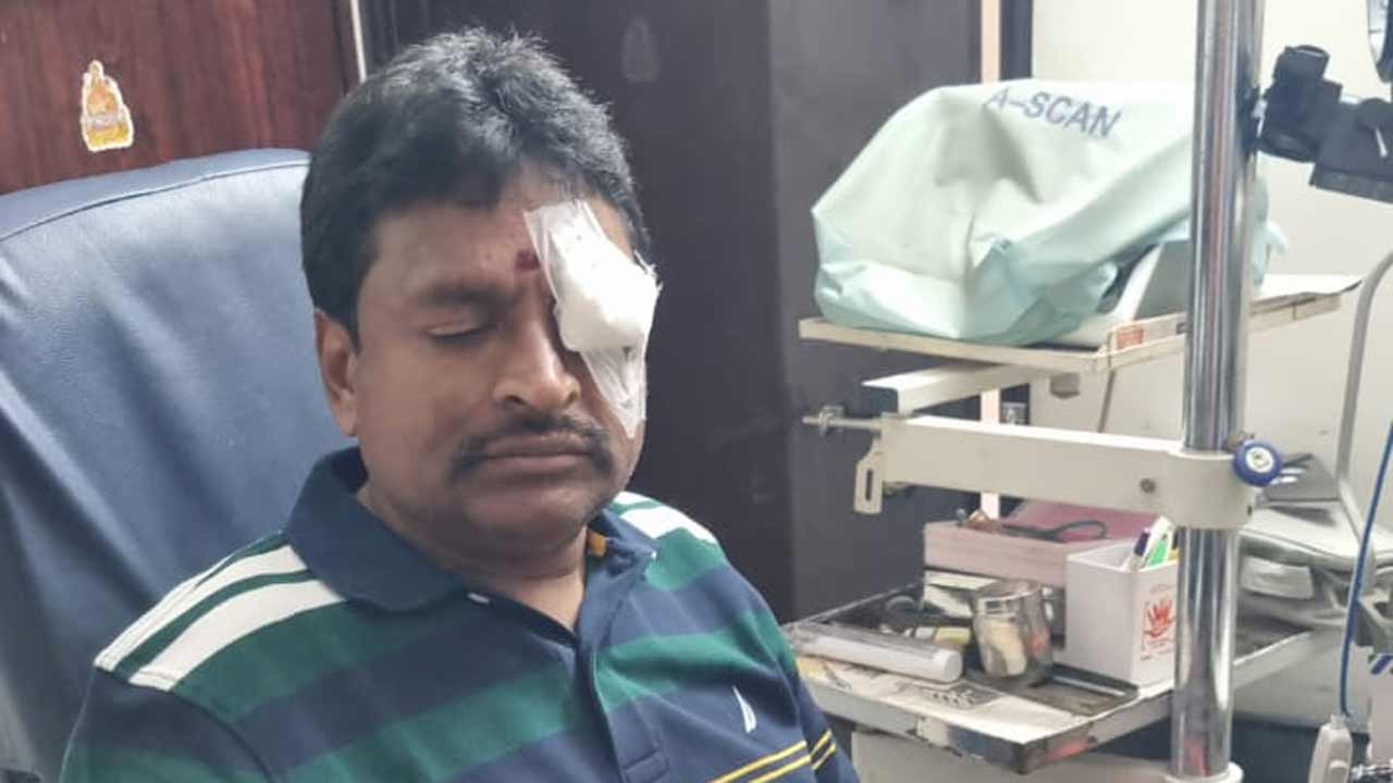 YS Jagan | నా ఎడమ కంటికి కూడా తీవ్ర గాయమైంది.. జగన్‌ను అంతమొందించేందుకు జరిగిన కుట్ర ఇది : వెల్లంపల్లి శ్రీనివాస్‌