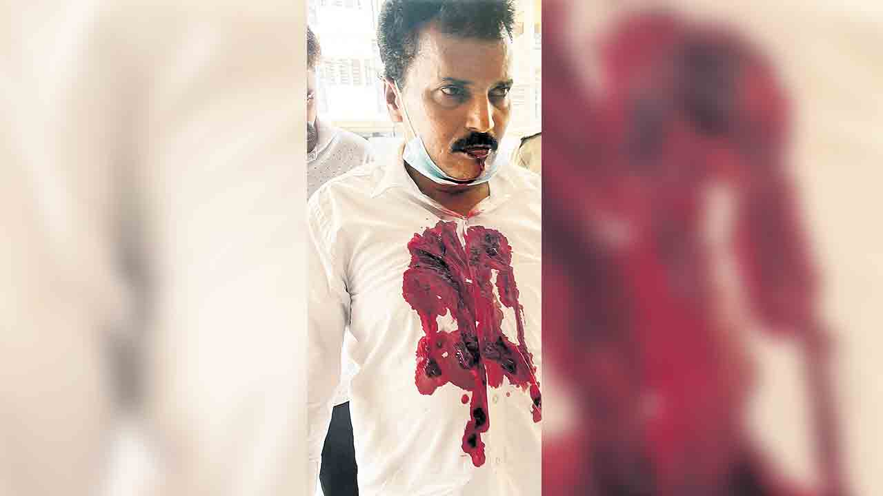 చంద్రబాబు గెలవాలని నాలుక కోసుకున్న ఆంధ్రావాసి