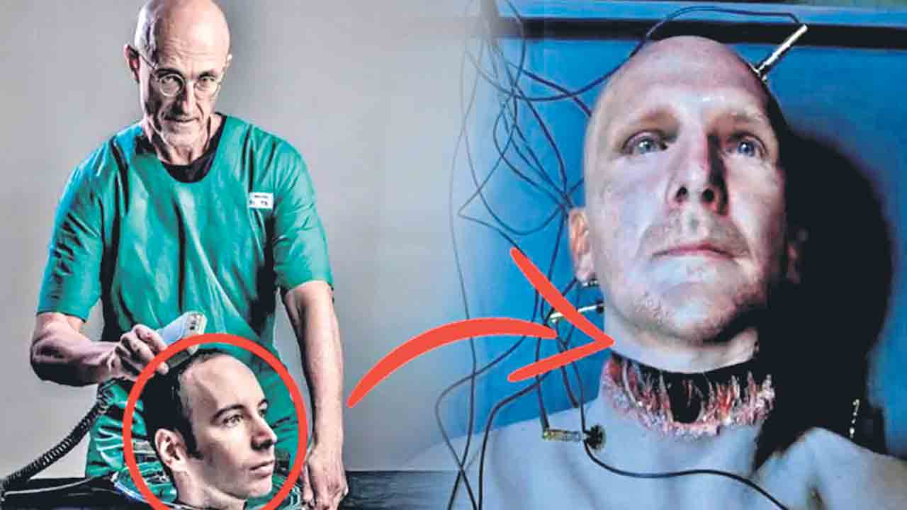 Head transplant | ఒకరి తల మరొకరికి.. ‘హెడ్‌ట్రాన్స్‌ప్లాంట్‌’ సాధ్యమేనంటున్న అమెరికా స్టార్టప్‌