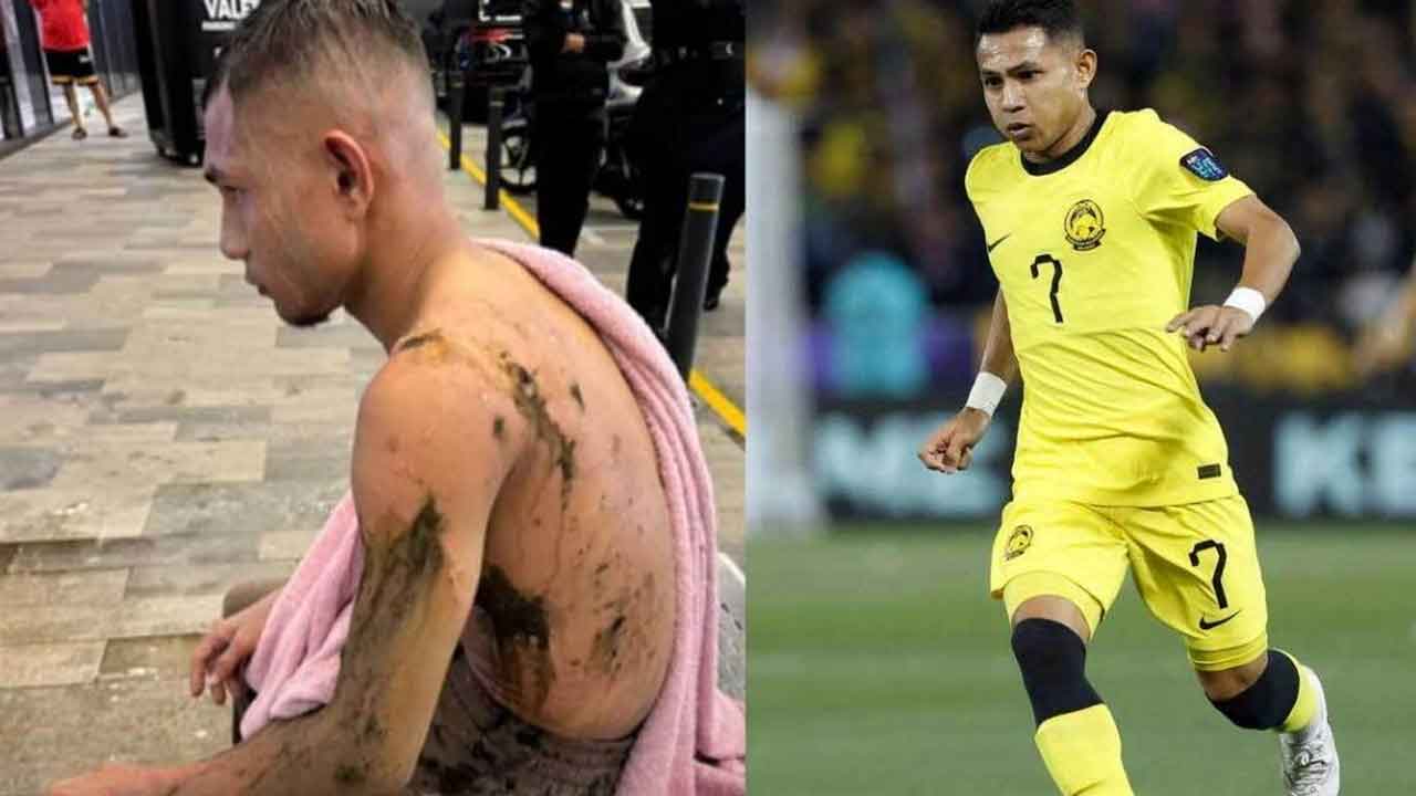 Faisal Halim | మలేషియా ఫుట్‌బాలర్‌పై యాసిడ్‌ దాడి