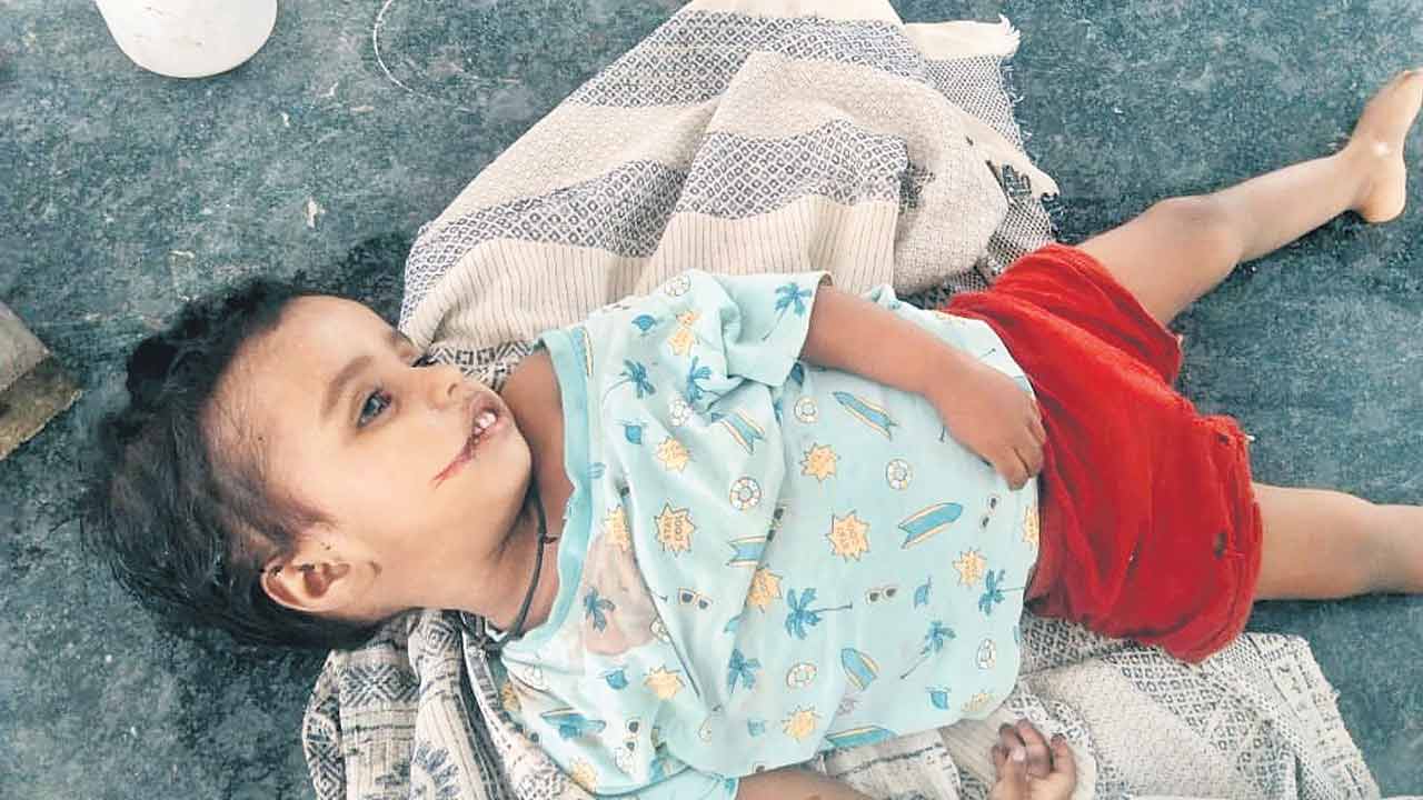 చిన్నారిపై సవతి తండ్రి కర్కశత్వం