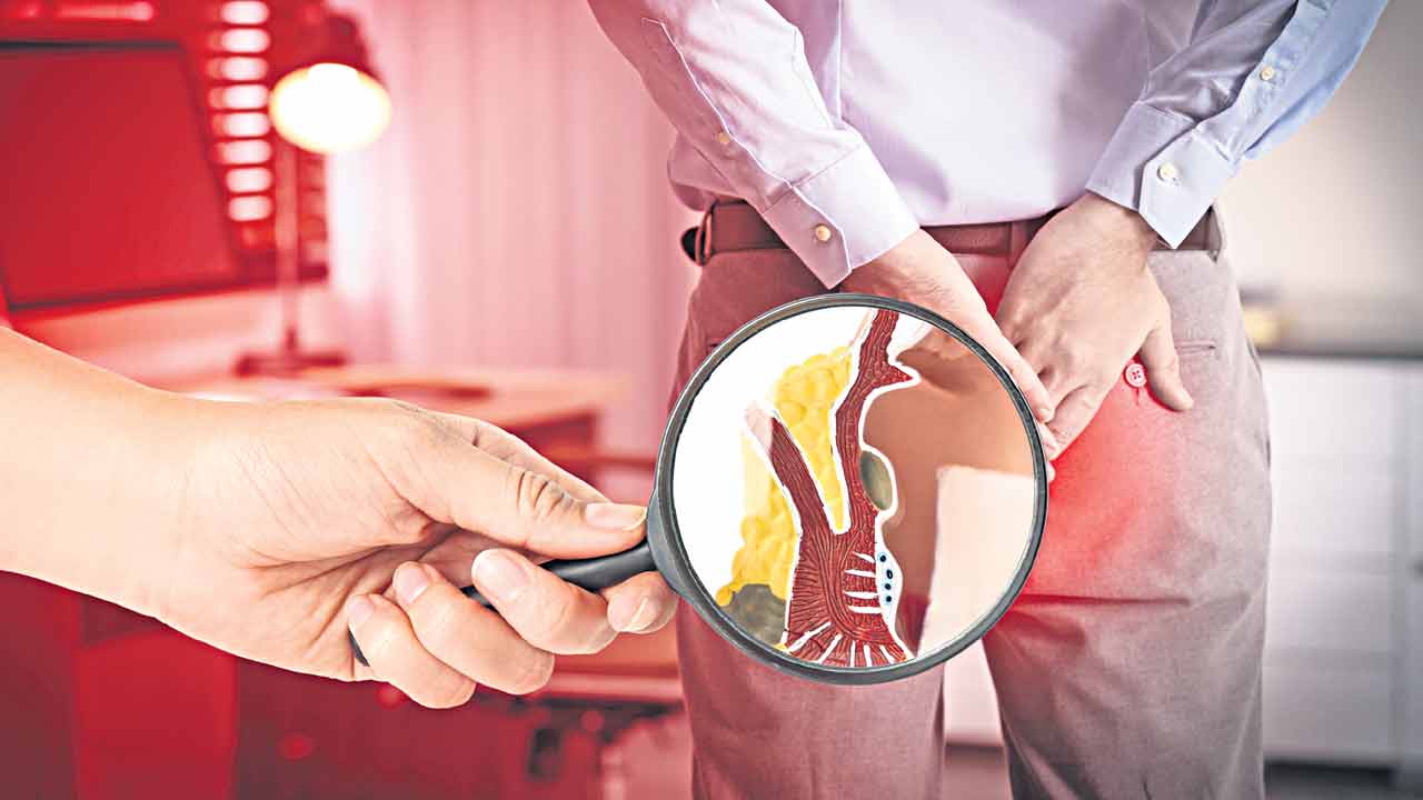 నో పైల్స్.. ఓన్లీ స్మైల్స్