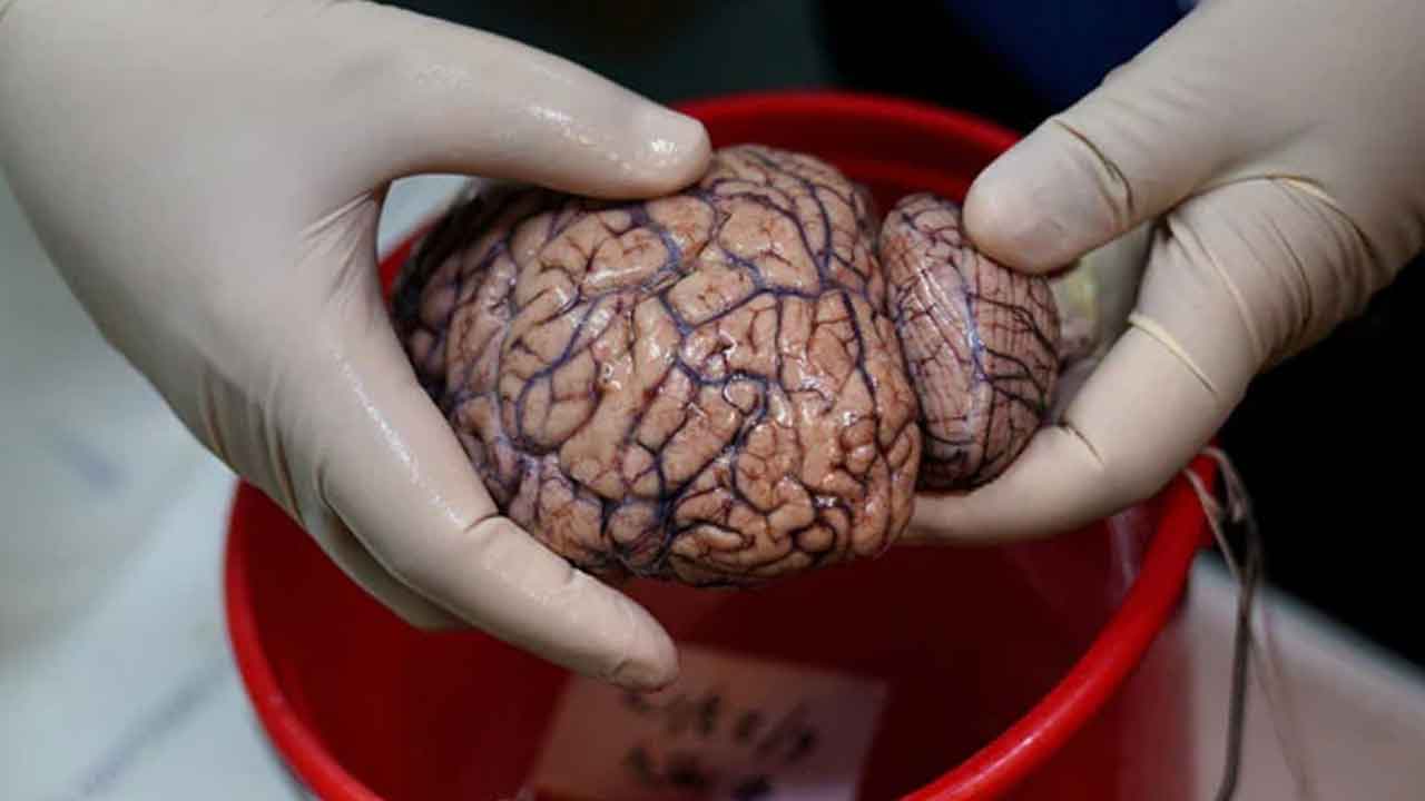 Brain reader | మెదడును చదివే మెషీన్‌.. ఆలోచనలకు అక్షర రూపమిచ్చే న్యూ టెక్నాలజీ