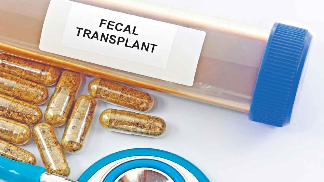 Fecal Transplant | మీ మలం ఖరీదు.. రూ. 1.4 కోట్లు