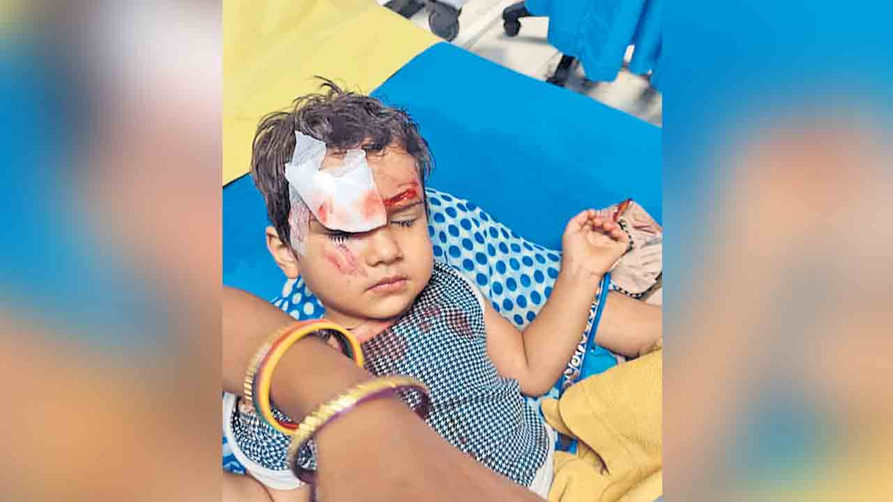 15 నెలల చిన్నారిపై.. వీధి కుక్కల దాడి