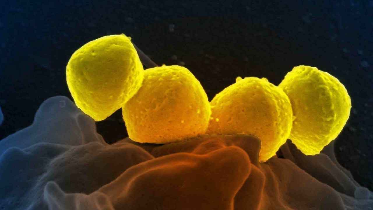 STSS | జపాన్‌ను వణికిస్తున్న మరో మహమ్మారి.. 48 గంటల్లో మనిషిని చంపేస్తుందట..!