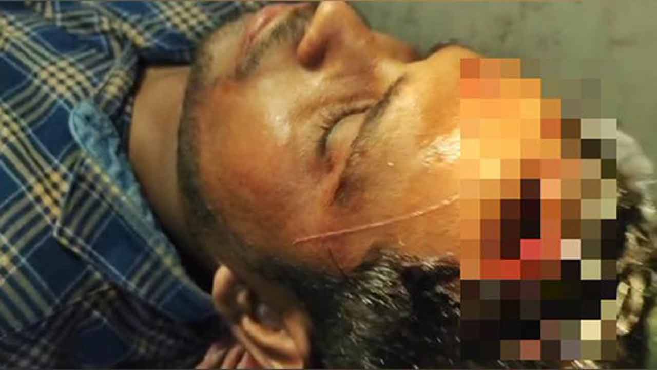 Lok Sabha polls | బెంగాల్‌లో తృణమూల్‌, బీజేపీ కార్యకర్తల మధ్య ఘర్షణ.. ANI స్ట్రింగర్‌కు తీవ్ర గాయాలు..