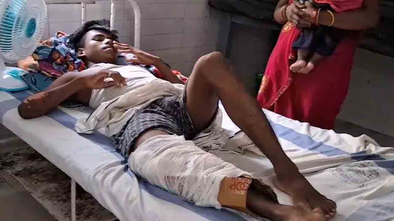 Fractured Leg With Cardboard | యువకుడికి విరిగిన కాలు..  అట్టముక్కతో కట్టుకట్టిన వైద్యులు