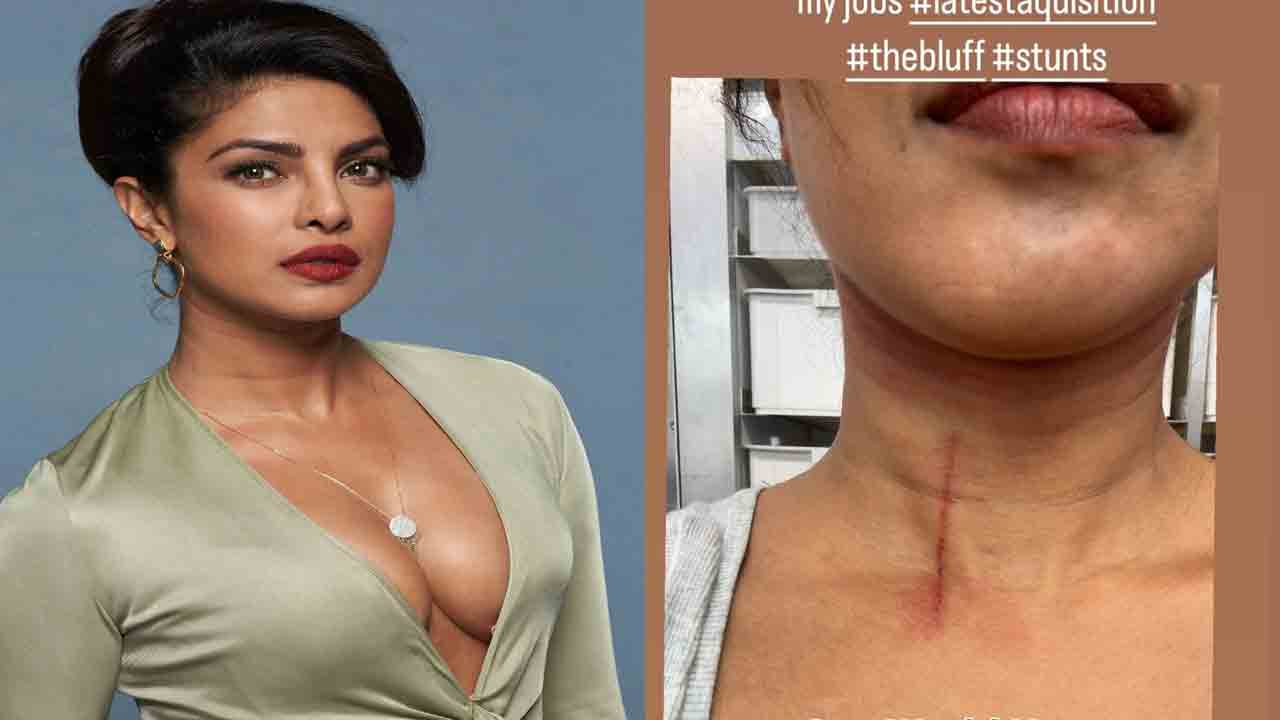 Priyanka Chopra | షూటింగ్‌లో ప్ర‌మాదం.. ప్రియాంక చోప్రాకు గాయాలు