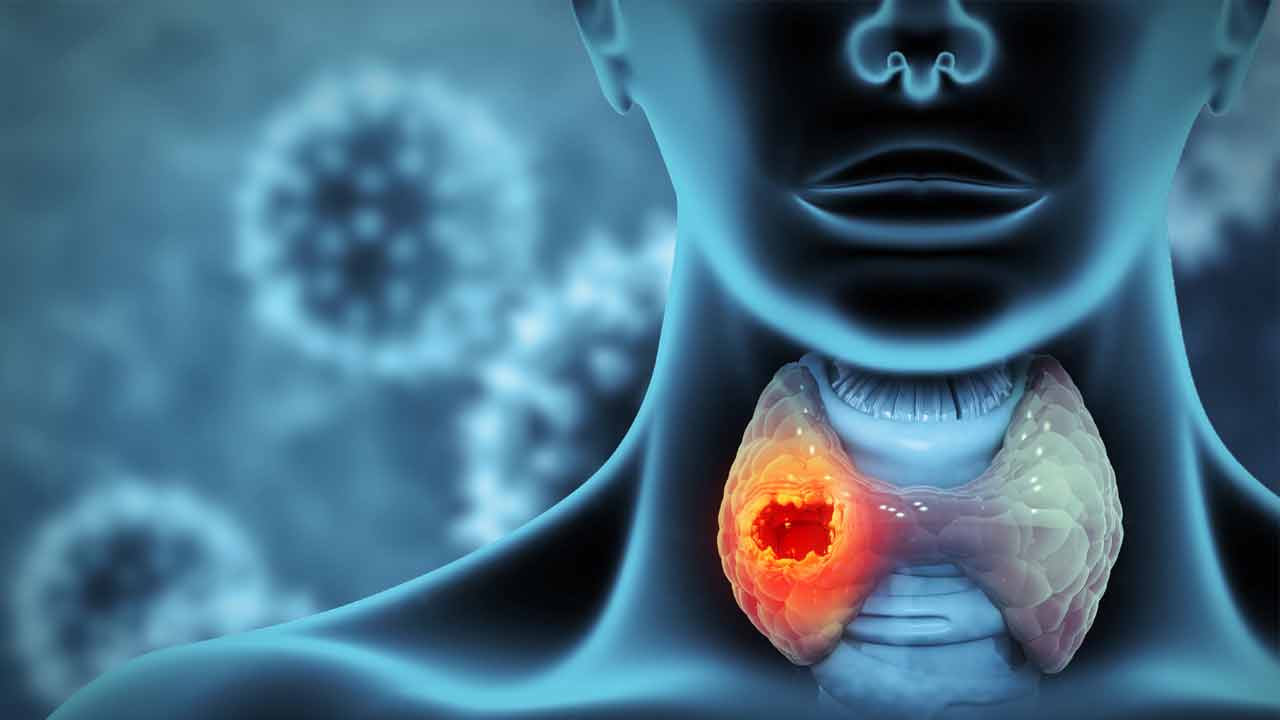 Thyroid1