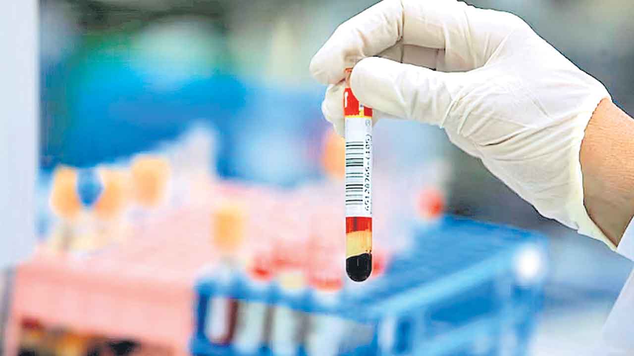 Parkinson’s Disease | రక్తపరీక్షతో పార్కిన్సన్స్‌ నిర్ధారణ.. 7 ఏండ్ల ముందే పసిగట్టొచ్చంటున్న పరిశోధకులు