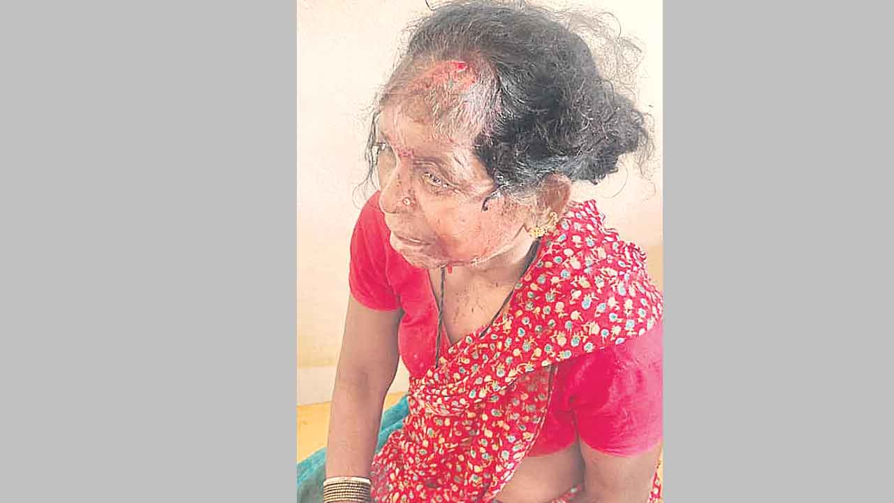 బీఆర్‌ఎస్‌ నేత కుటుంబంపై కాంగ్రెస్‌ దాడి