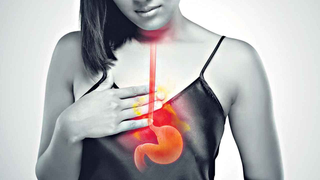 మాత్ర లేకుండా.. ఎసిడిటీ మాయం