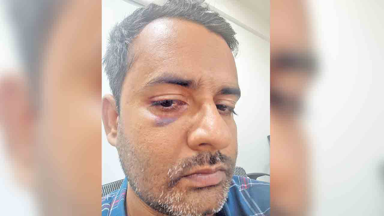 సైడ్‌ ఇవ్వలేదని జర్నలిస్టుపై దాడి