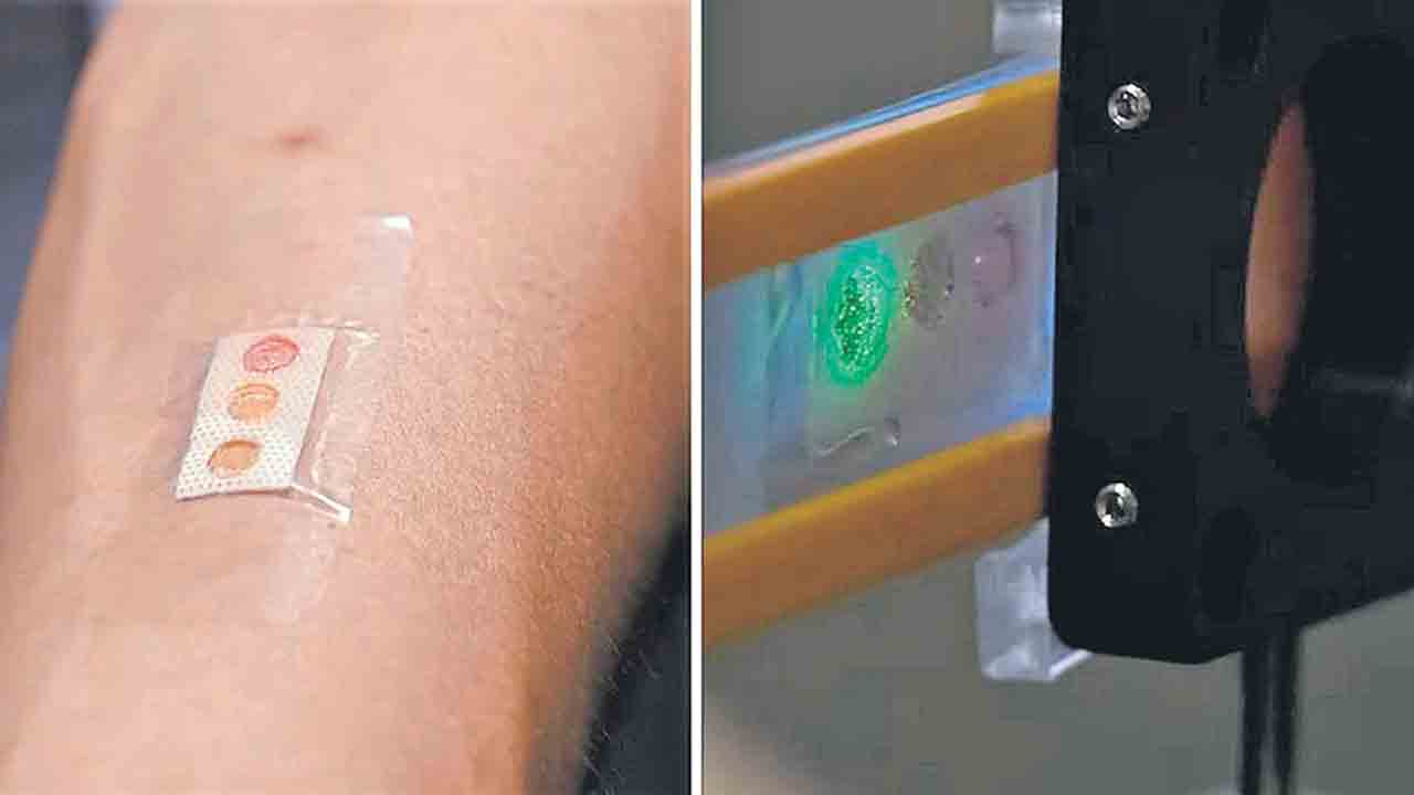 మధుమేహులకు లేజర్‌ బ్యాండేజీ