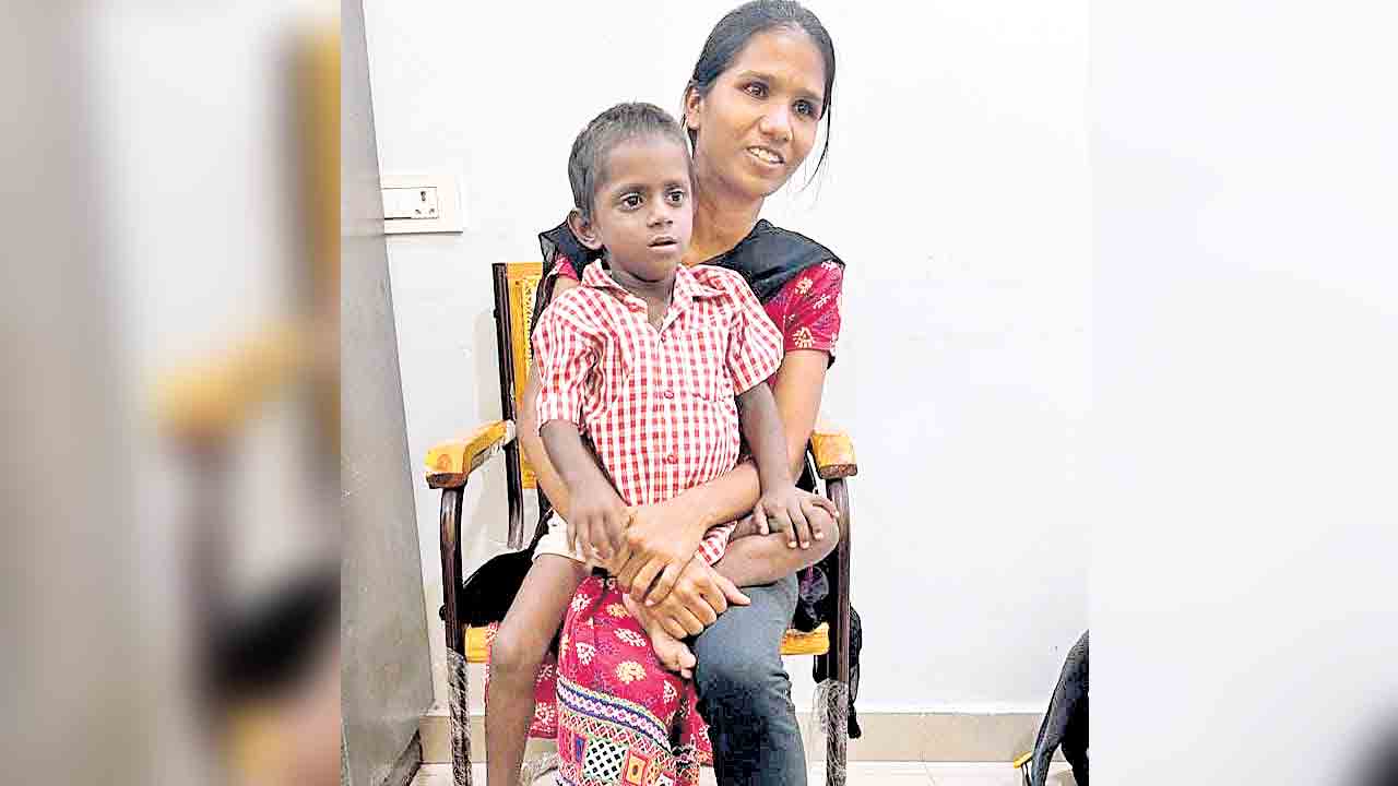 ఉస్మానియాలో అరుదైన శస్త్రచికిత్స